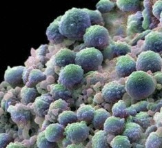 Вирус кори помогает в лечении онкологии