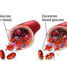 Как правильно проверить уровень глюкозы в крови