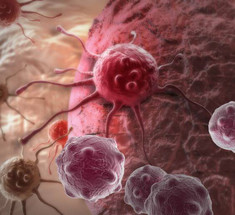 Афера в индустрии лечения рака: на химиотерапии по ложным диагнозам наживают миллиарды долларов