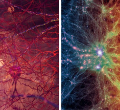 Человеческий мозг удивительно похож на Вселенную