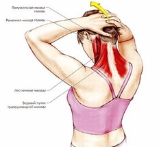 Разгибатели шеи: постизометрическая релаксация затылочно-позвоночных мышц