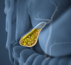Желчные люди: 5 болезней, которые могут прятаться в желчном пузыре