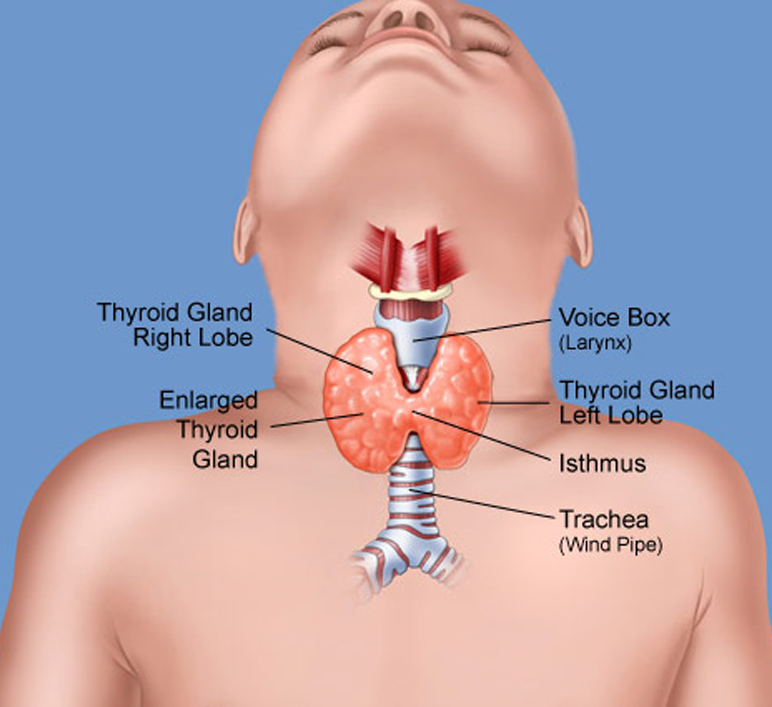 Увеличенная щитовидной железы у детей. Болезни щитовидки у детей. Щитовидная железа у детей 8 лет.