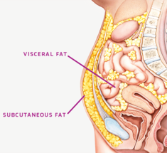 ЖИВОТный жир: Чем опасен висцеральный жир и что делать?