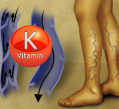 Витамин K: Состояние сосудов, уменьшение варикозного расширения вен