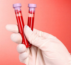 Старение: 8 маркеров крови и как их улучшить