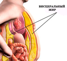 Висцеральный жир: искореняем источник проблемы