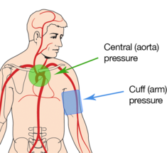 Ошибки при измерении артериального давления: ТОП-6