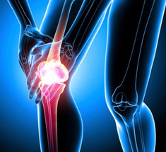 Болят суставы: что надо знать об артрите