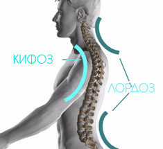 6 эффективных упражнений при ПОЯСНИЧНОМ ЛОРДОЗЕ 
