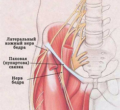 Упражнения при неврите наружного кожного нерва бедра