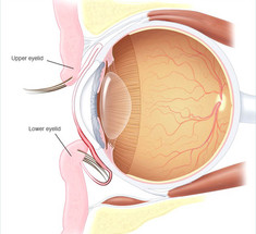 ГЛАУКОМА: потерю зрения можно замедлить или предупредить