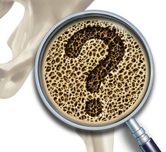 Остеопороз: 5 главных признаков, которые важно не пропустить на раннем этапе