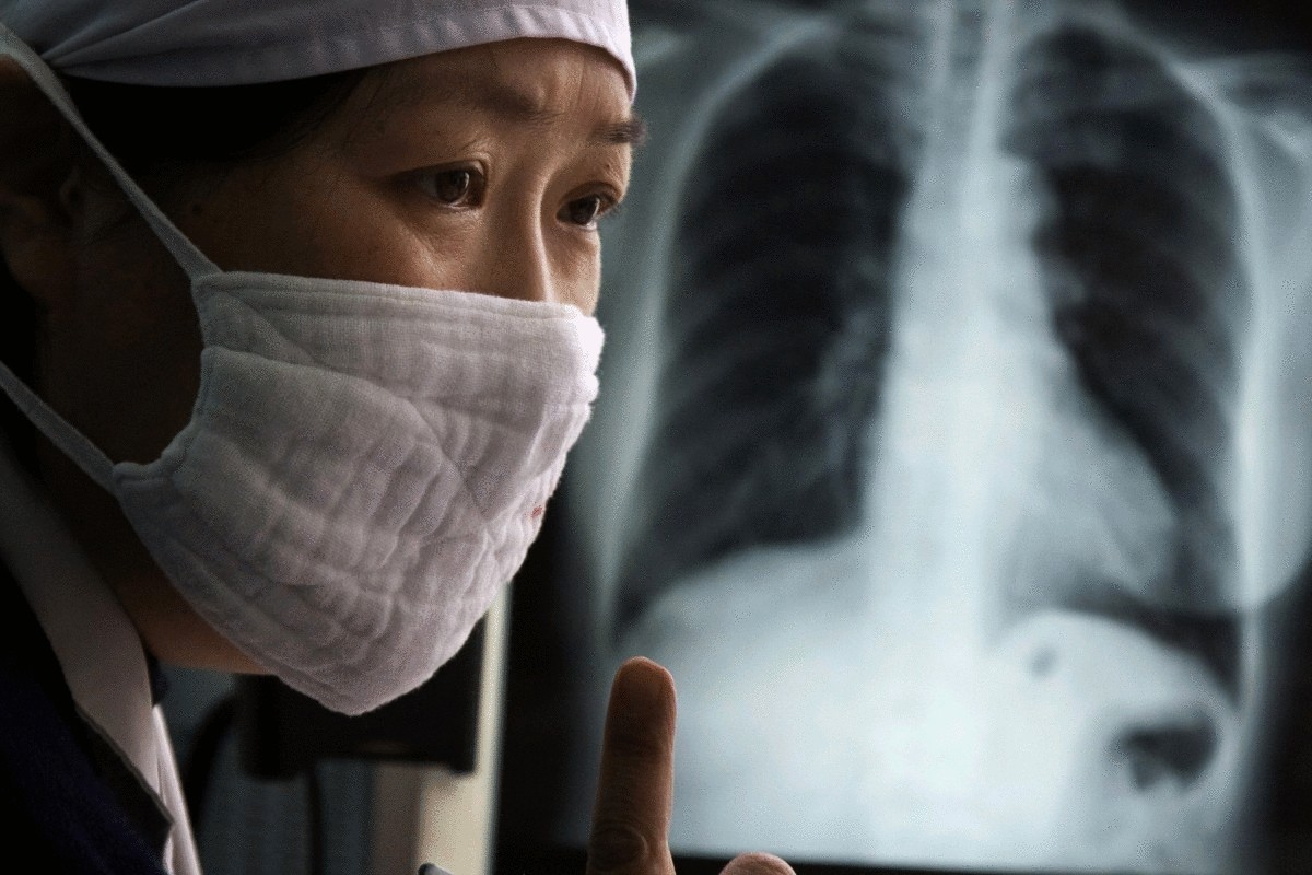 Чего боится туберкулёз?