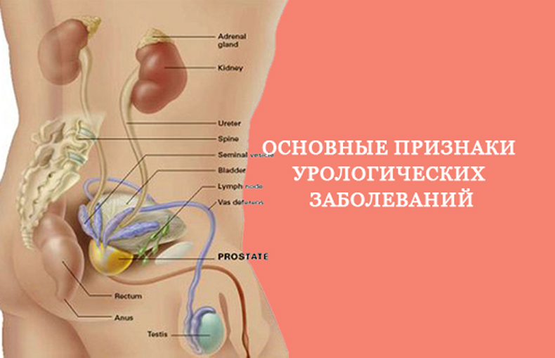 Урологические заболевания. Симптомы урологических заболеваний. Основные признаки урологических заболеваний. Симптоматика урологических заболеваний урология. Урологические заболевания у мужчин.