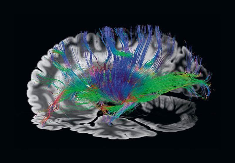 7 кинезиологических упражнений для интеграции работы правого и левого полушарий головного мозга