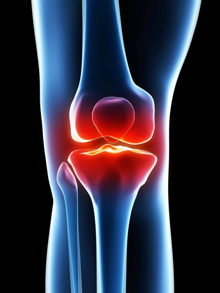 Упражнения при болях в коленных суставах