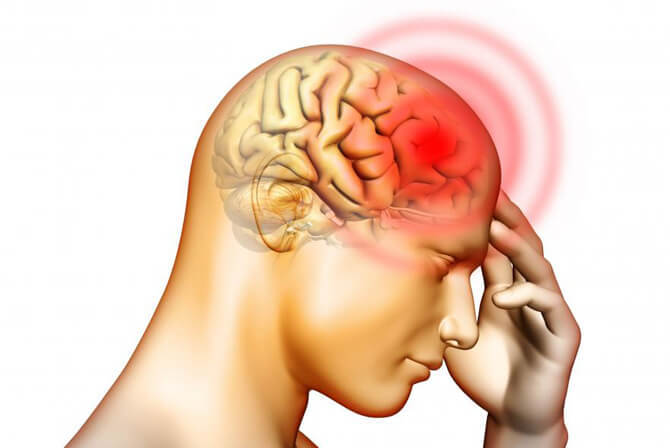 Симптомы головной боли, вызванной нервным напряжением