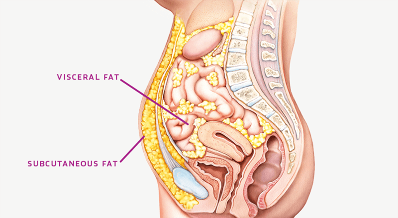 ЖИВОТный жир: Чем опасен висцеральный жир и что делать?