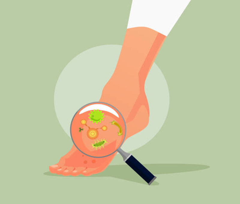 Грибок ногтей: Как победить при помощи уксуса и пищевой соды?