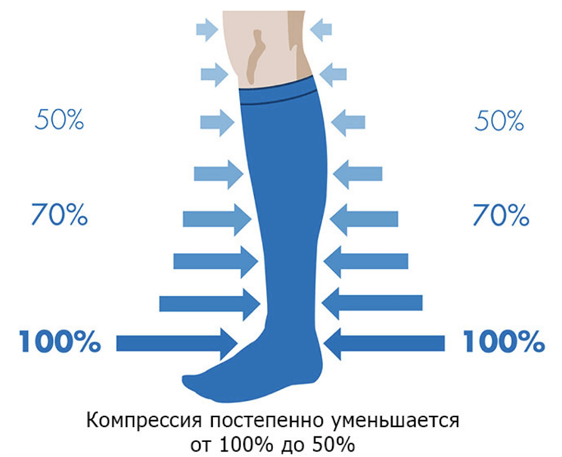 Венозная недостаточность – болезнь цивилизации