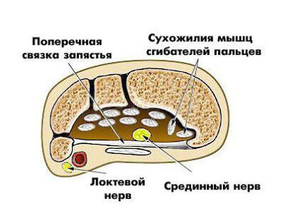 Что делать при туннельном синдроме