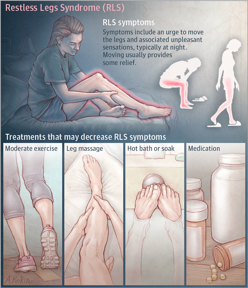 Что делать при синдроме беспокойных ног