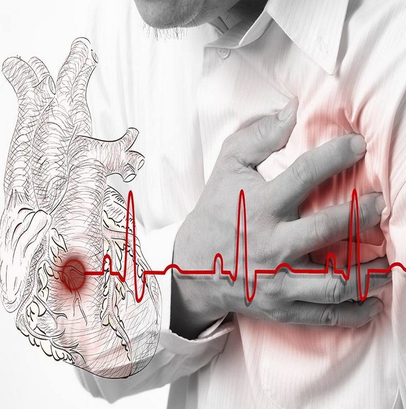 Микроинфаркт: Симптомы и первые признаки у мужчин и женщин