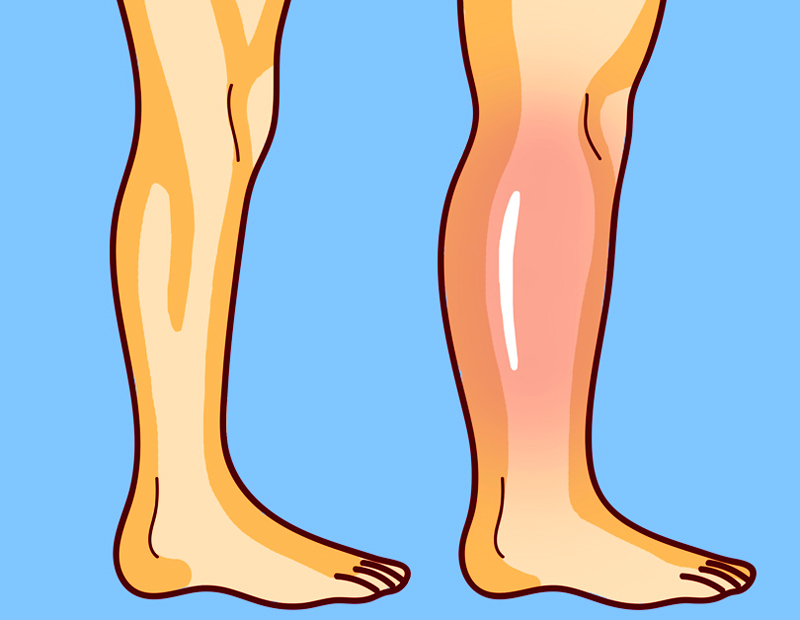 3 простых упражнения от остеопата для снятия отеков ног