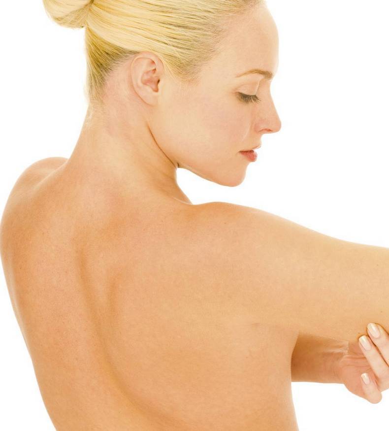 Псориаз: как правильно ухаживать за кожей 
