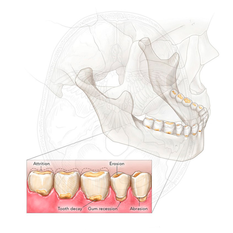 Биохакинг: белые зубы и оптимальное здоровье полости рта