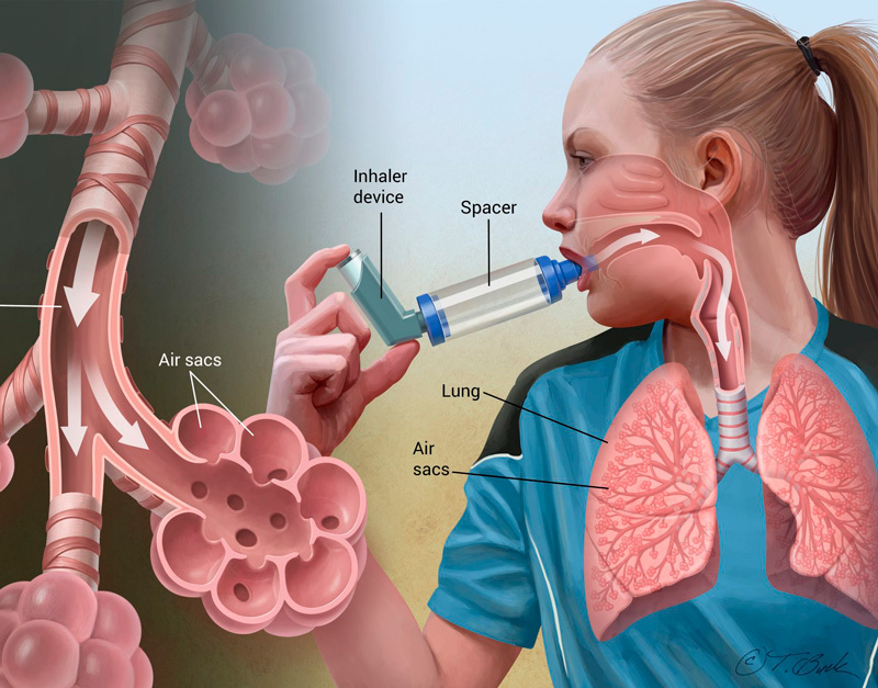 Астма: добавки для здоровья дыхательной системы