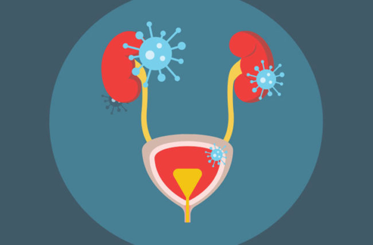 Инфекции мочевых путей (ИМП) - симптомы, причины и естественные средства для лечения