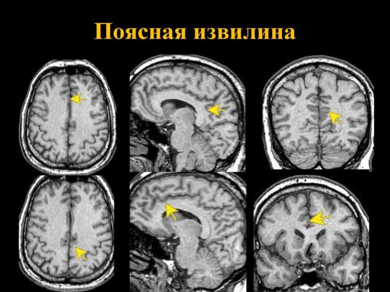 Мозг в банке: где у человека «сознание»